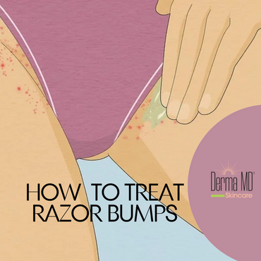 How to get rid of razor bumps