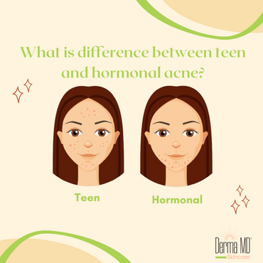 What is the difference between teen and hormonal acne?