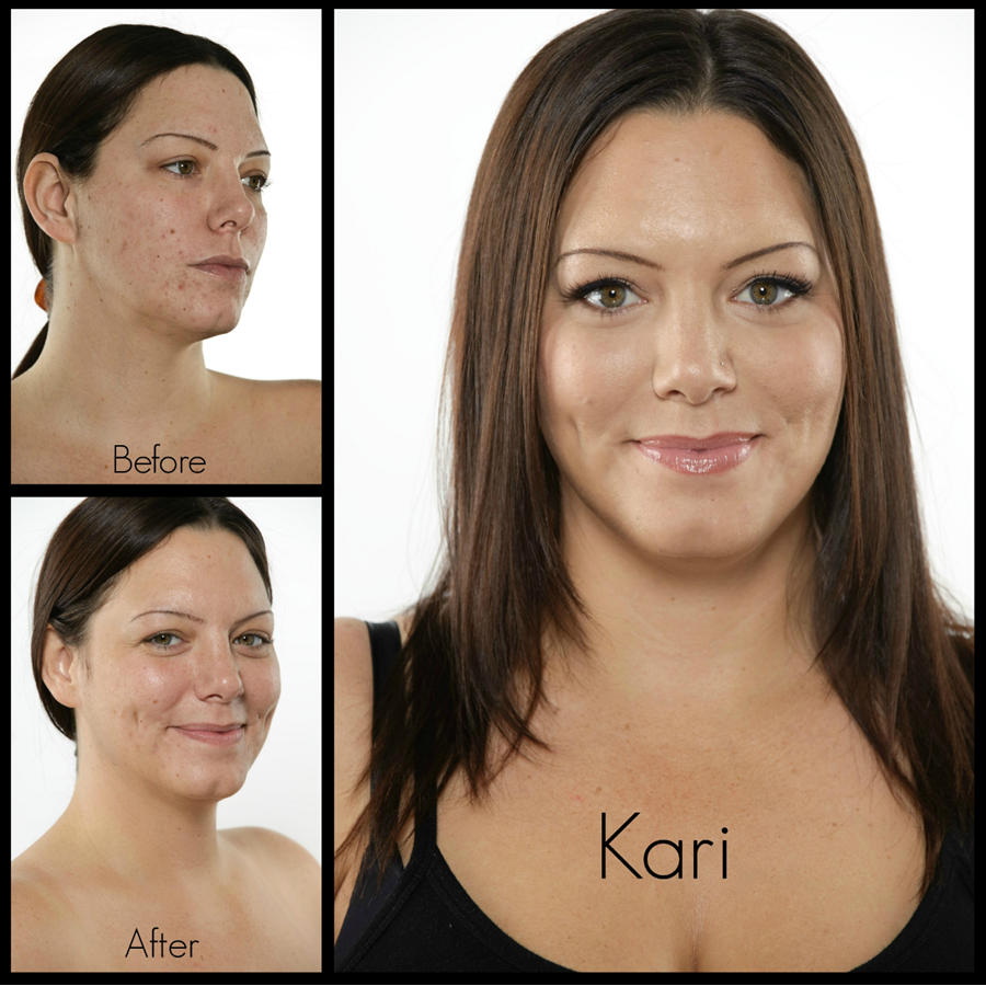 Wasabi Anti Acne 3-STEP SYSTEM
