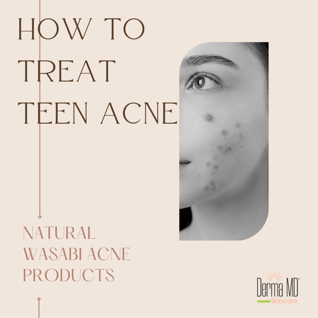 How to Treat Teen Acne