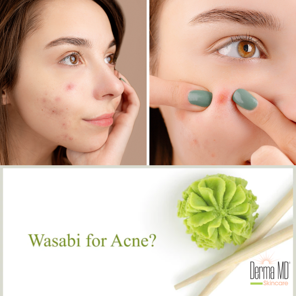 Wasabi for Treating Acne?
