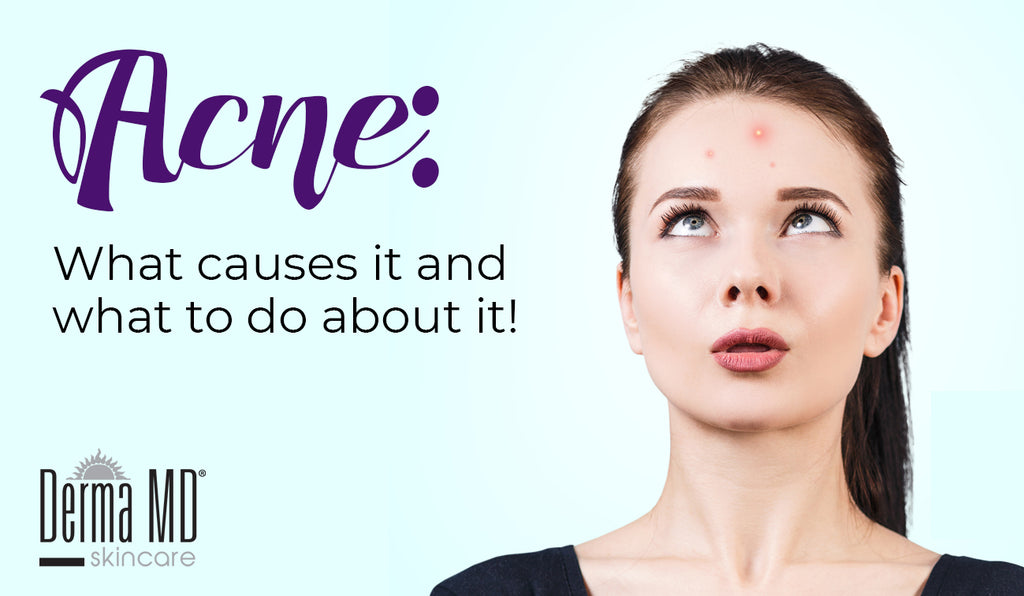 What causes acne (and what to do about it!)