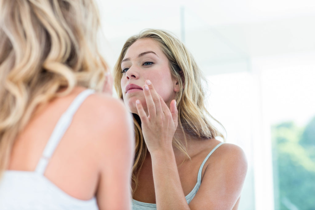 How to Treat & Prevent Mild Acne